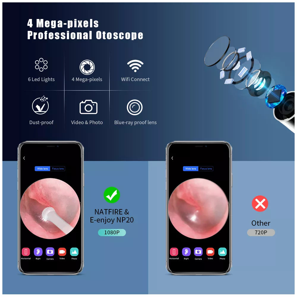 VisuEar™ SmartClean: Wireless Visual Ear Wizard